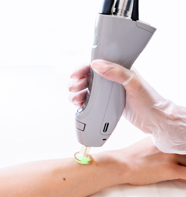 Professional Alexandrite Laser Hair Removal Machine