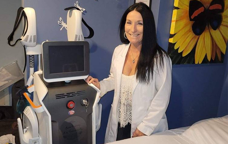 renaface before and after