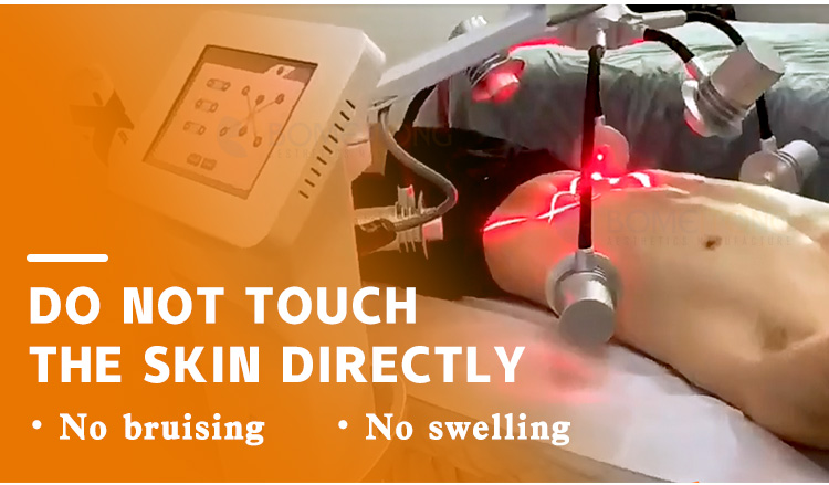 10d lipo laser machine